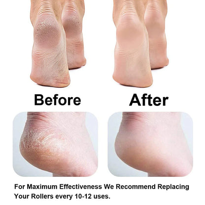 Electric Pedicure Tool – Say Goodbye to Calluses Instantly!🌟