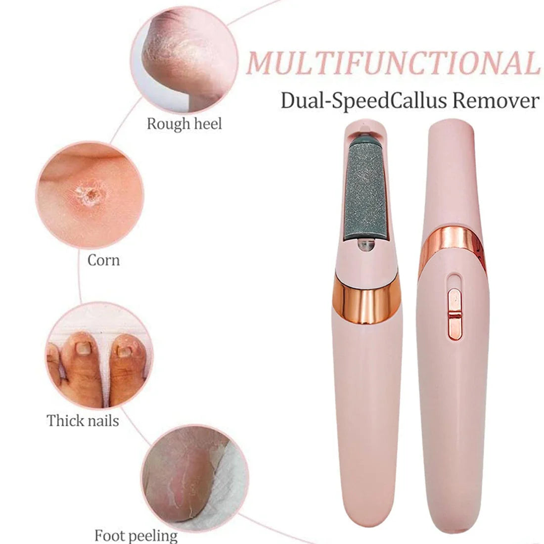 Electric Pedicure Tool – Say Goodbye to Calluses Instantly!🌟